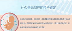 成都胎儿亲子鉴定要如何办理，成都产前亲子鉴定结果到底准不准确